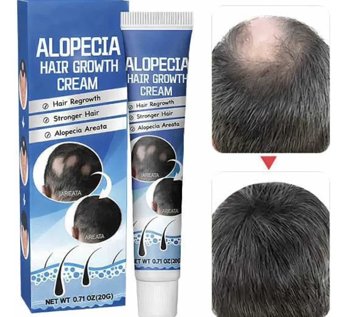 2 Cremas Tratamiento Alopecia Crecimiento Capilar