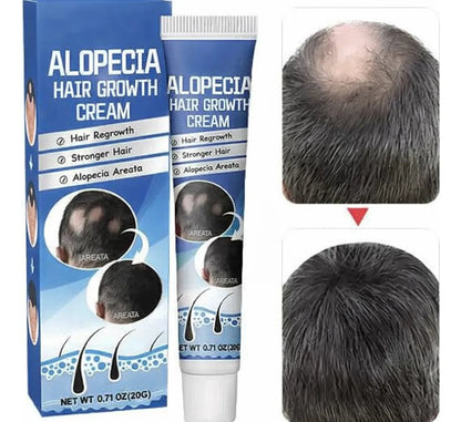2 Cremas Tratamiento Alopecia Crecimiento Capilar